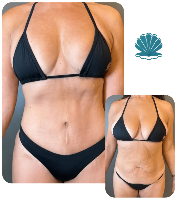 Resultado antes e depois