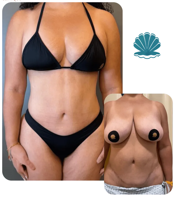 Resultado antes e depois