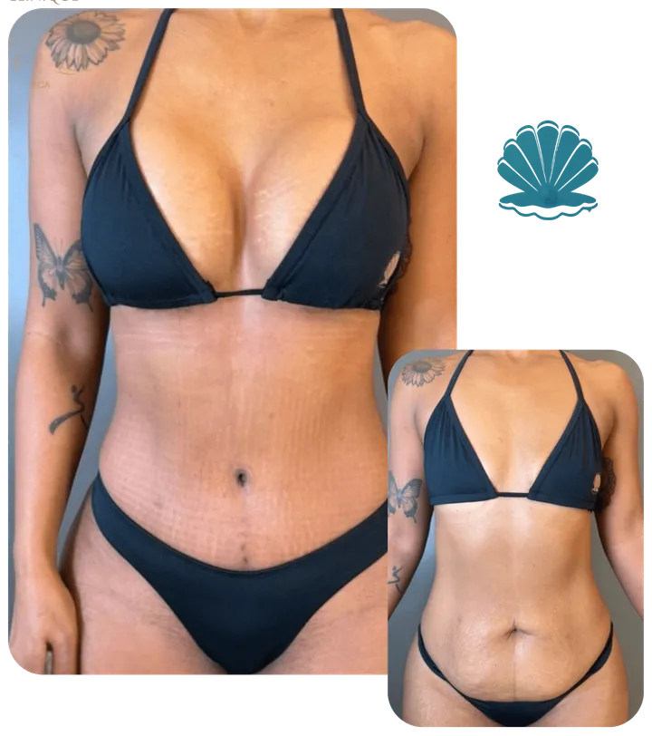 Resultado antes e depois