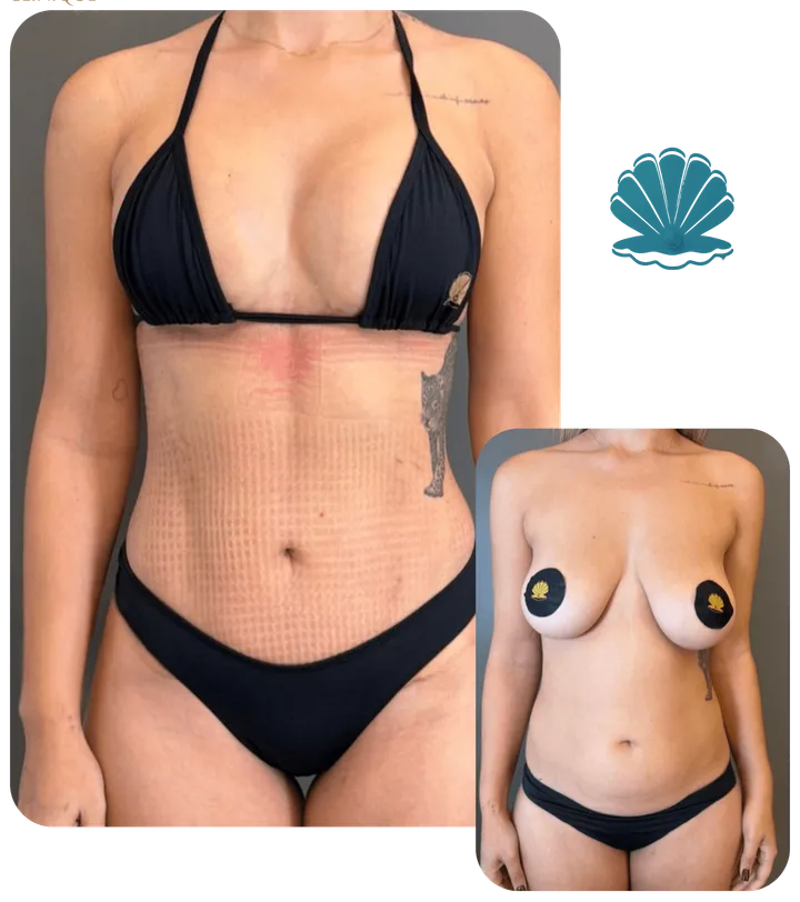 Resultado antes e depois
