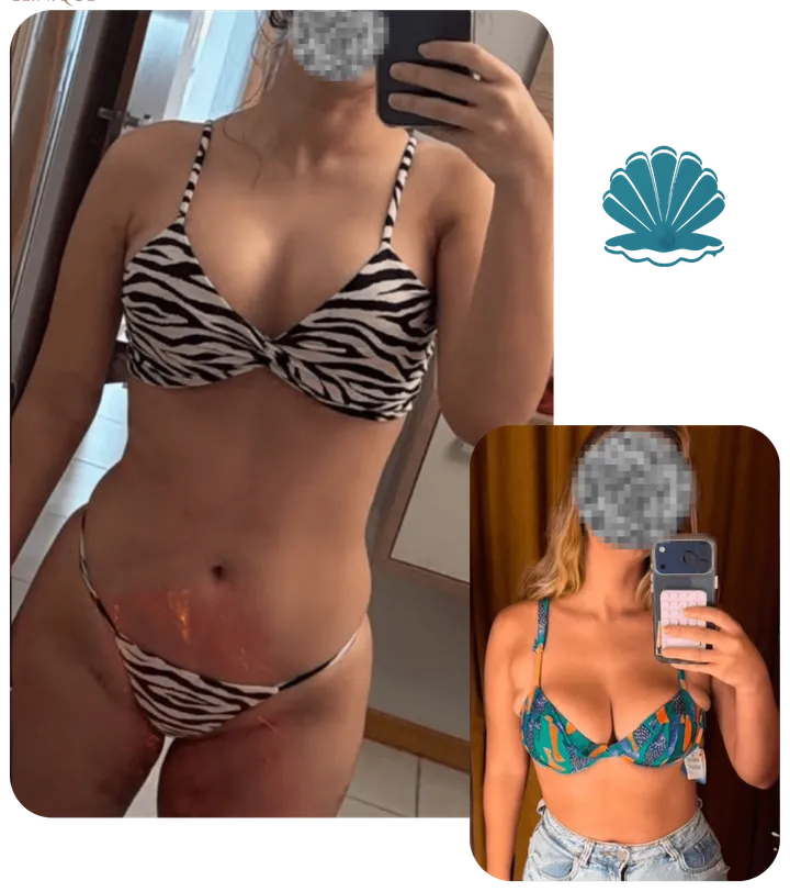 Resultado antes e depois