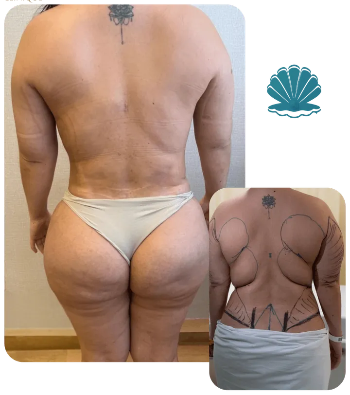 Resultado antes e depois