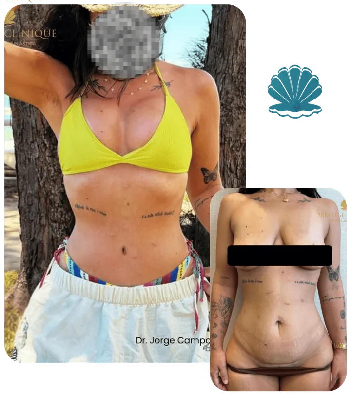 Resultado antes e depois