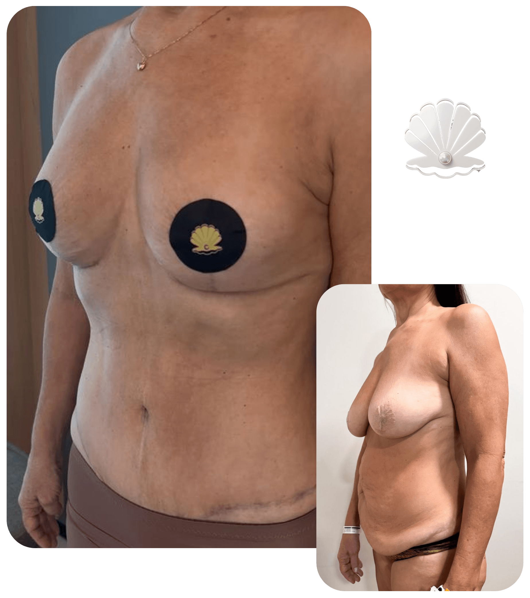 Resultado antes e depois