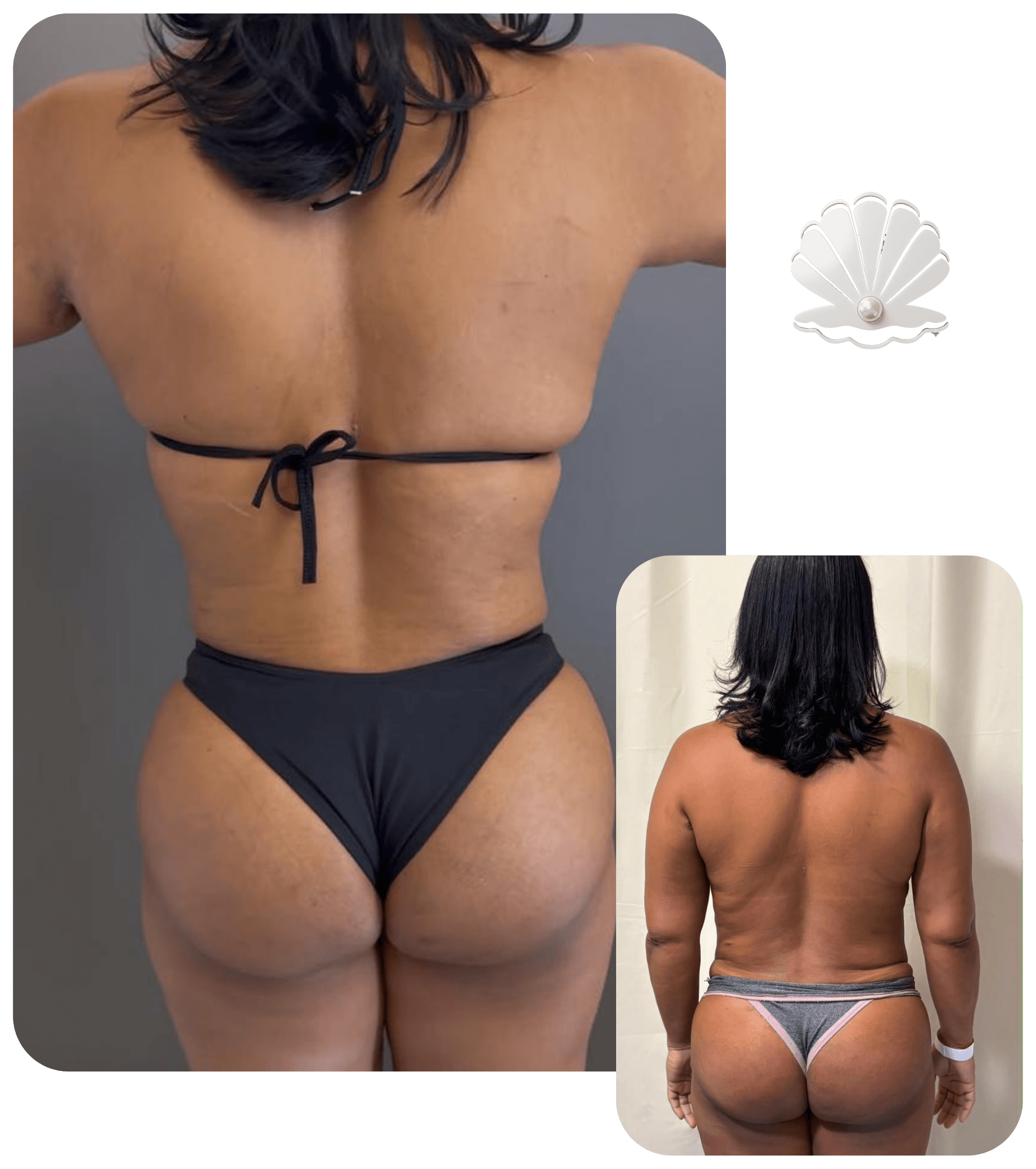Resultado antes e depois