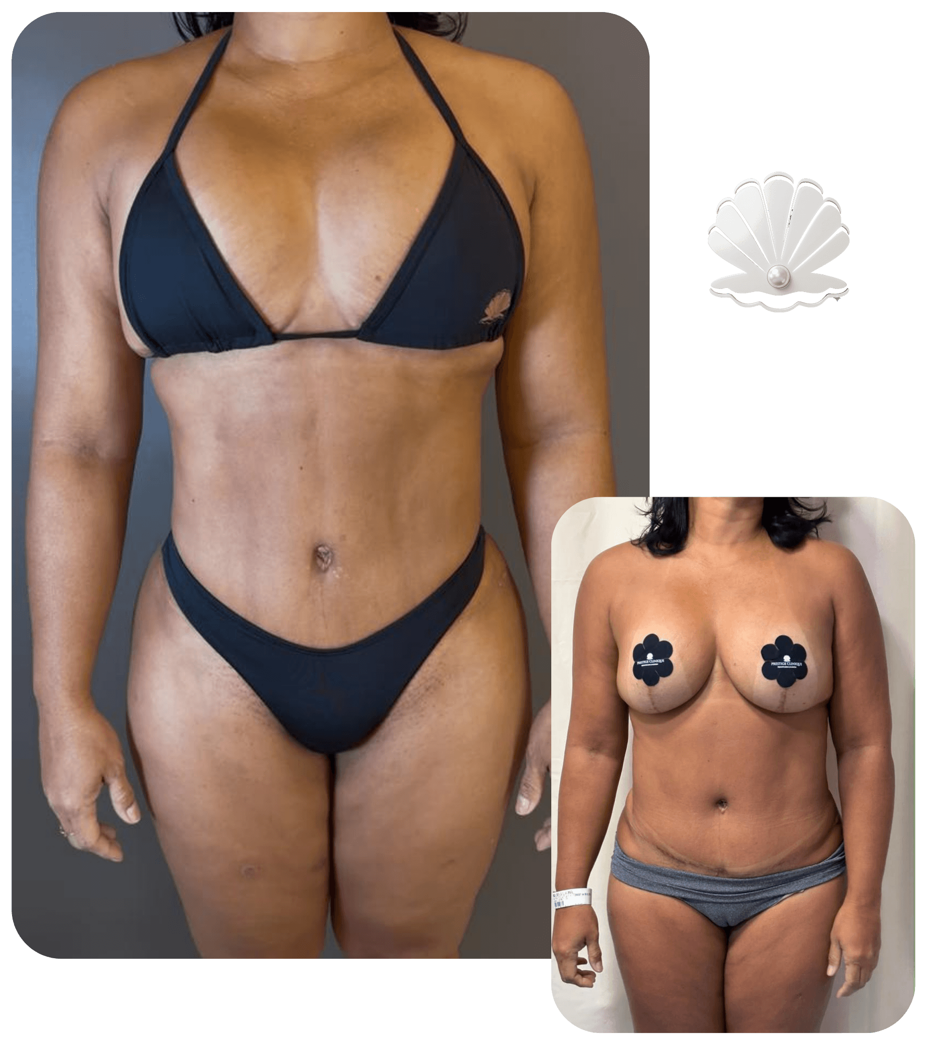 Resultado antes e depois